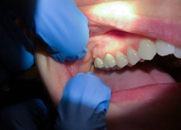 Best Emergency Dentist for Knocked-Out Tooth in Genoa, OH