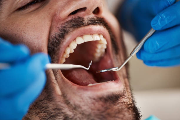 Best Broken or Cracked Tooth Emergency Dentist in Genoa, OH