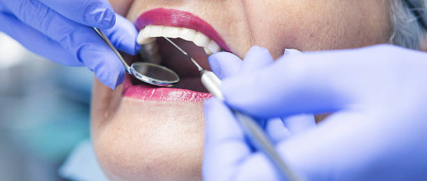 Best Emergency Root Canal Treatment in Genoa, OH